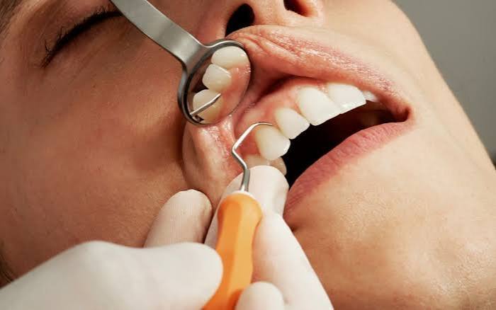 How Sedation Dentistry in Encino Can Ease Dental Anxiety